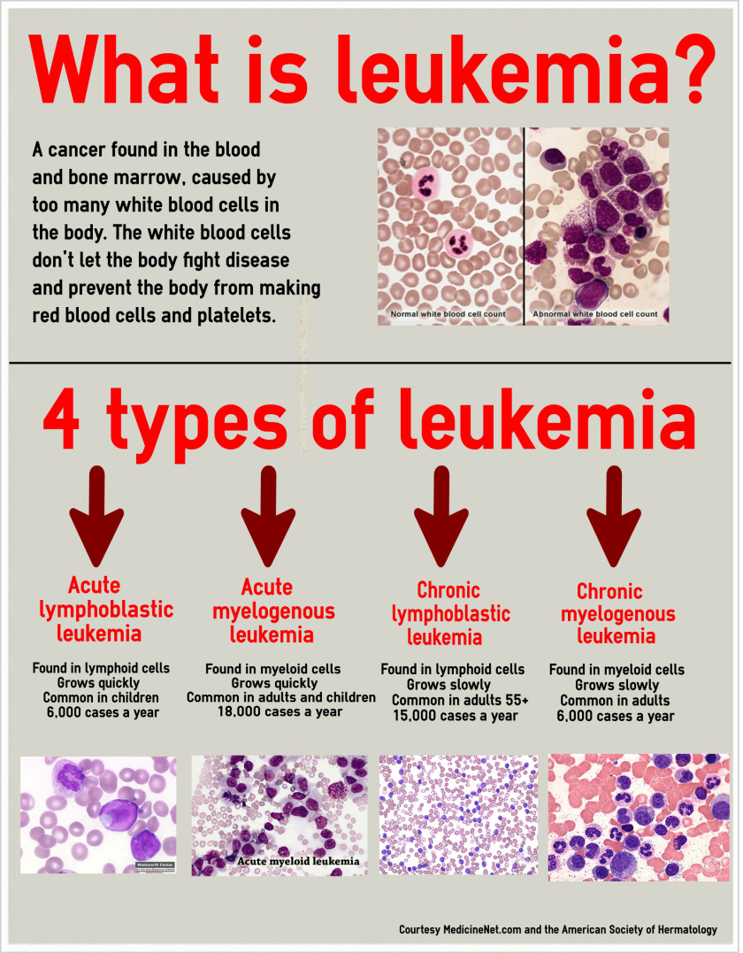 leukemia what
